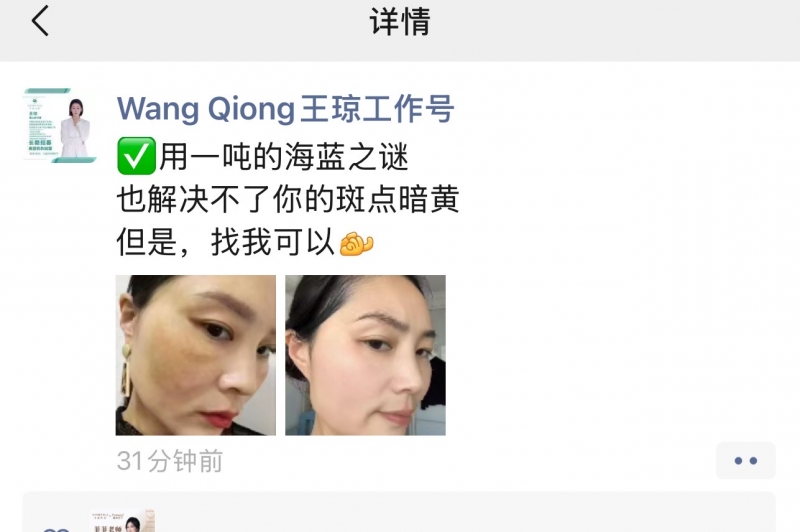 书颜世家：精准焕白，告别斑点暗黄的终极答案